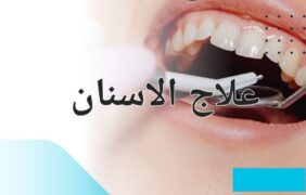 علاج الاسنان